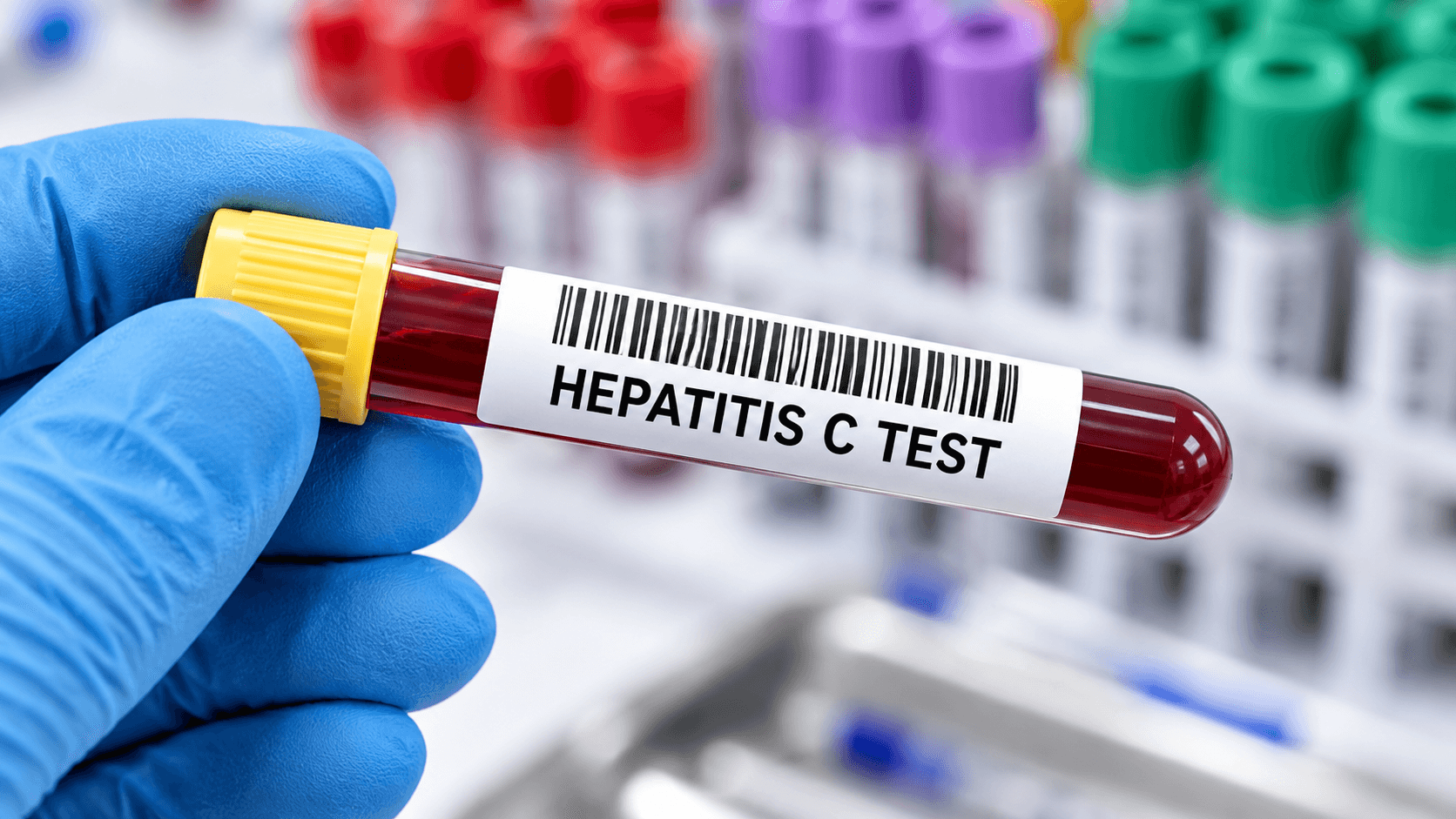 Pakistan Hepatitis C screening drive for people aged 12 and above